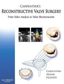 Carpentier\'s Reconstructive Valve Surgery: From Valve Analysis to Valve Reconstruction (Carpentier Alain)(Pevná vazba)